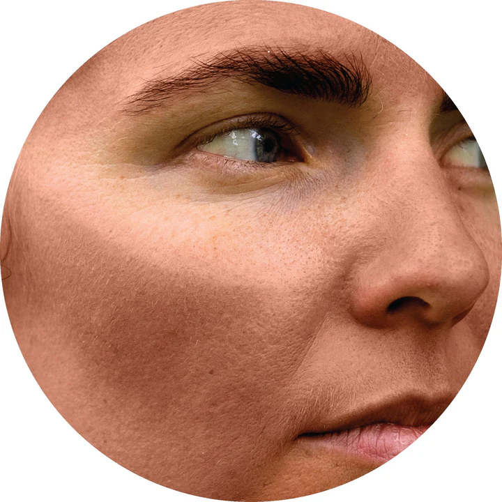 Custom image