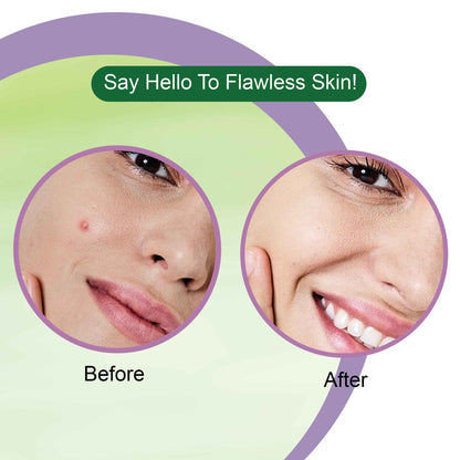 Neem Acne Pimple Patch Glow