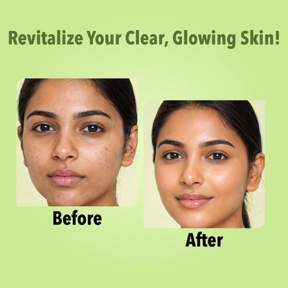 Aloe Vera Facial Pack of 4 (scrub, Gel, Cream & Facepack) - 1520 ml