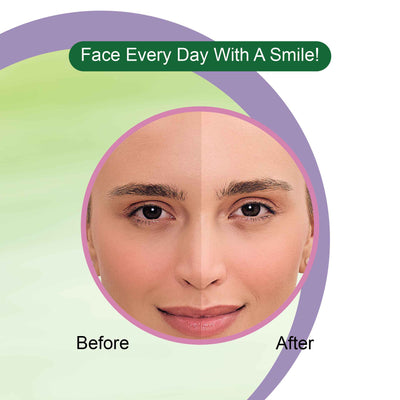 Aloe Vera Day Cream Before and After