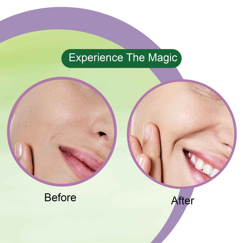 Aloe Vera Serum Before After