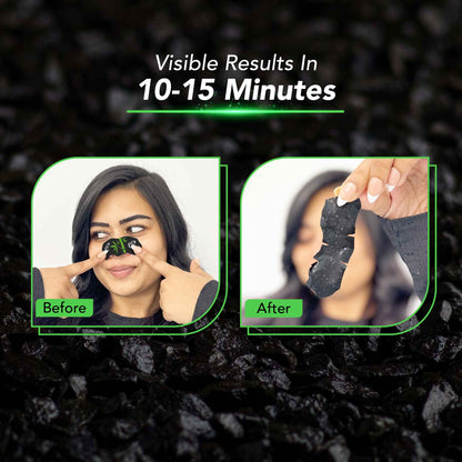 Charcoal Nose Strips for Blackheads Removal & Soothing Wet Wipes Combo Pack