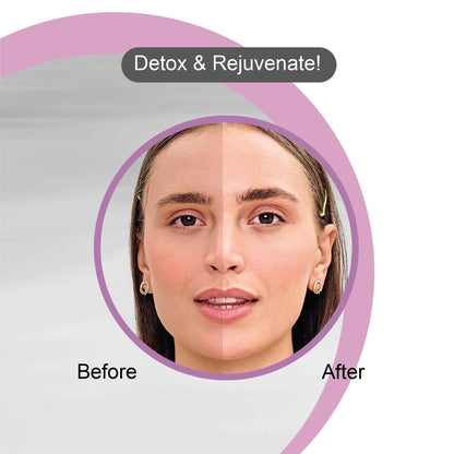 Charcoal Face Gel Before After