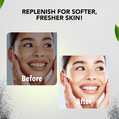 Charcoal Facial Pack of 4 (Scrub, Gel, Cream & Facepack) - 1520 ml