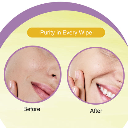 Detan Face Wet Wipes Pack of 6