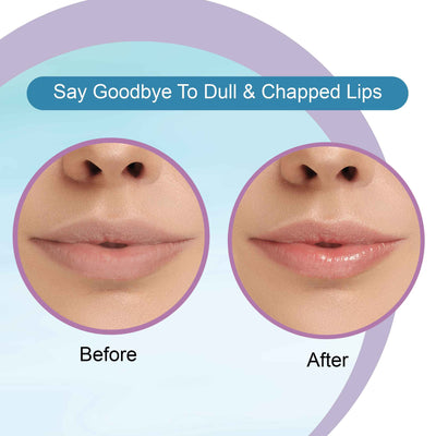 Hyaluronic Acid Lip Balm