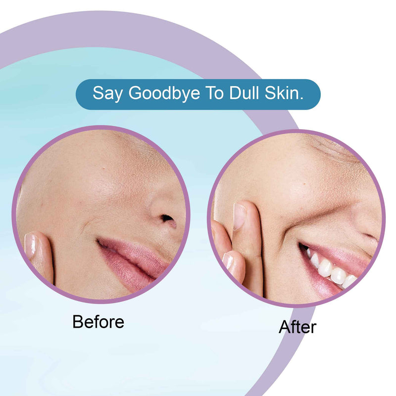 Hyaluronic Acid Face Wash Before After