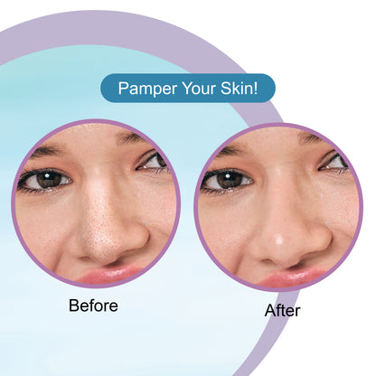 Hyaluronic Acid Nose Strips & Soothing Wet Wipes Combo Pack (20 pcs)