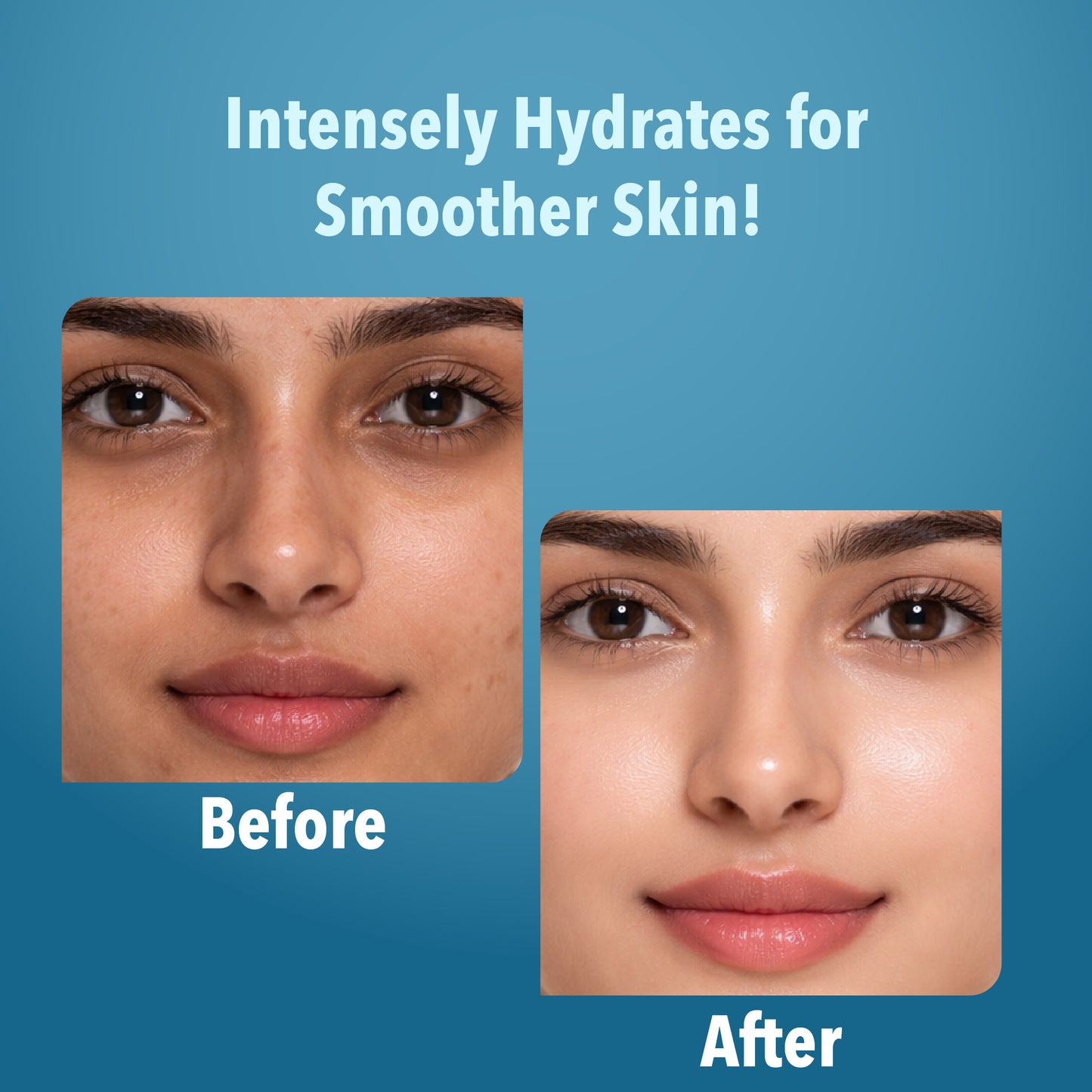 Hyaluronic Acid Facial Pack of 4 (scrub, Gel, Cream & Facepack) - 1520 ml