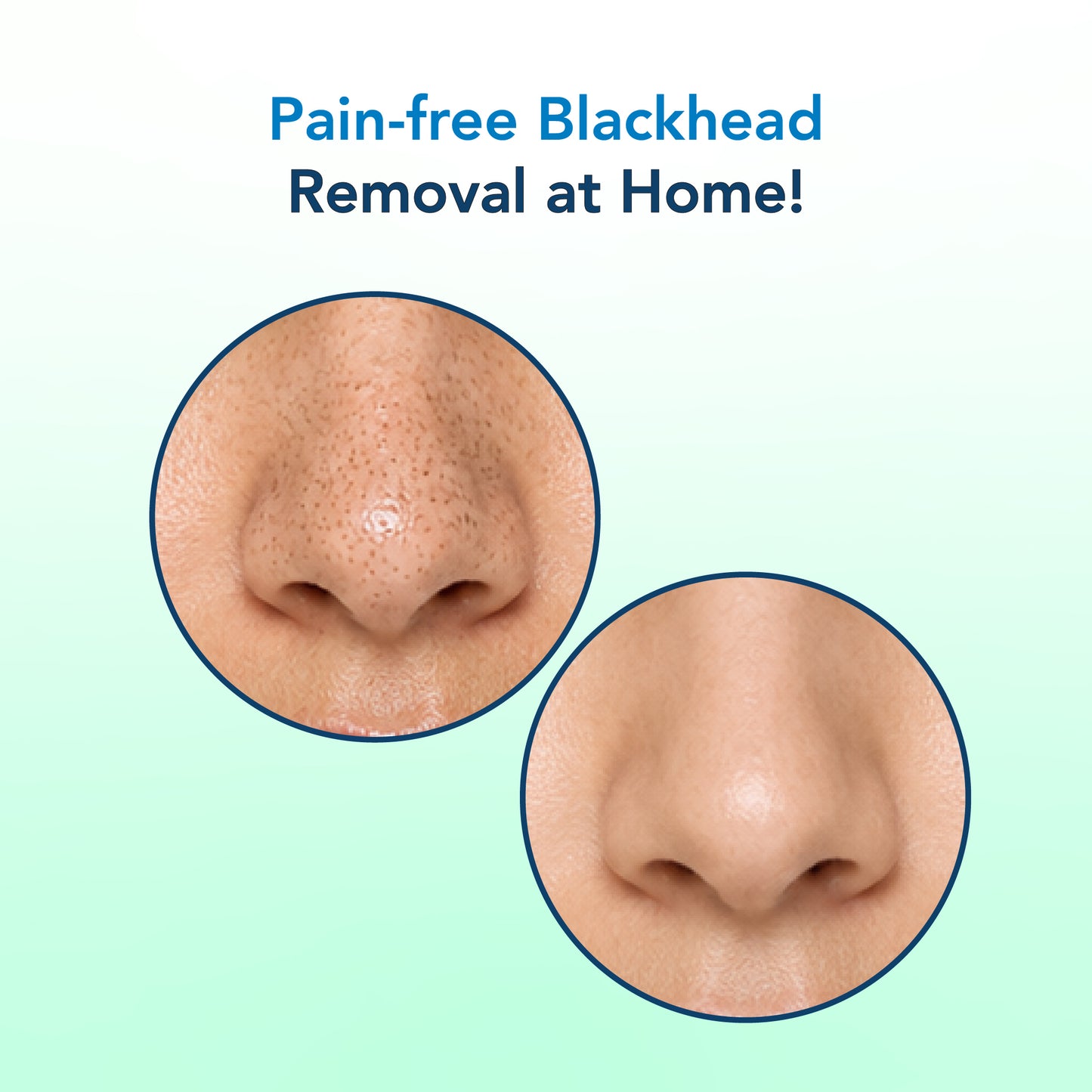 Korean Glass Skin Essence Nose Strips 3 PCS