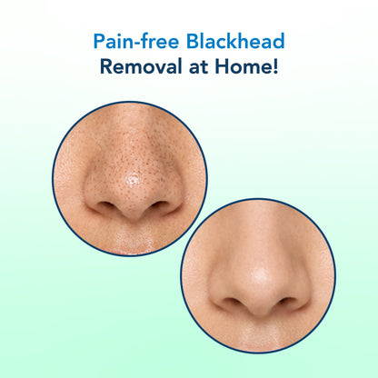 Korean Glass Skin Essence Nose Strips 3 PCS