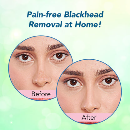 Korean Glass Skin Essence Nose Strips