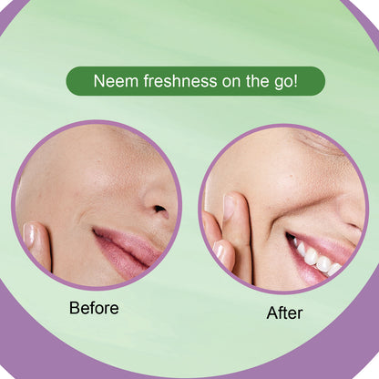 Neem Wet Wipes Pack of 6