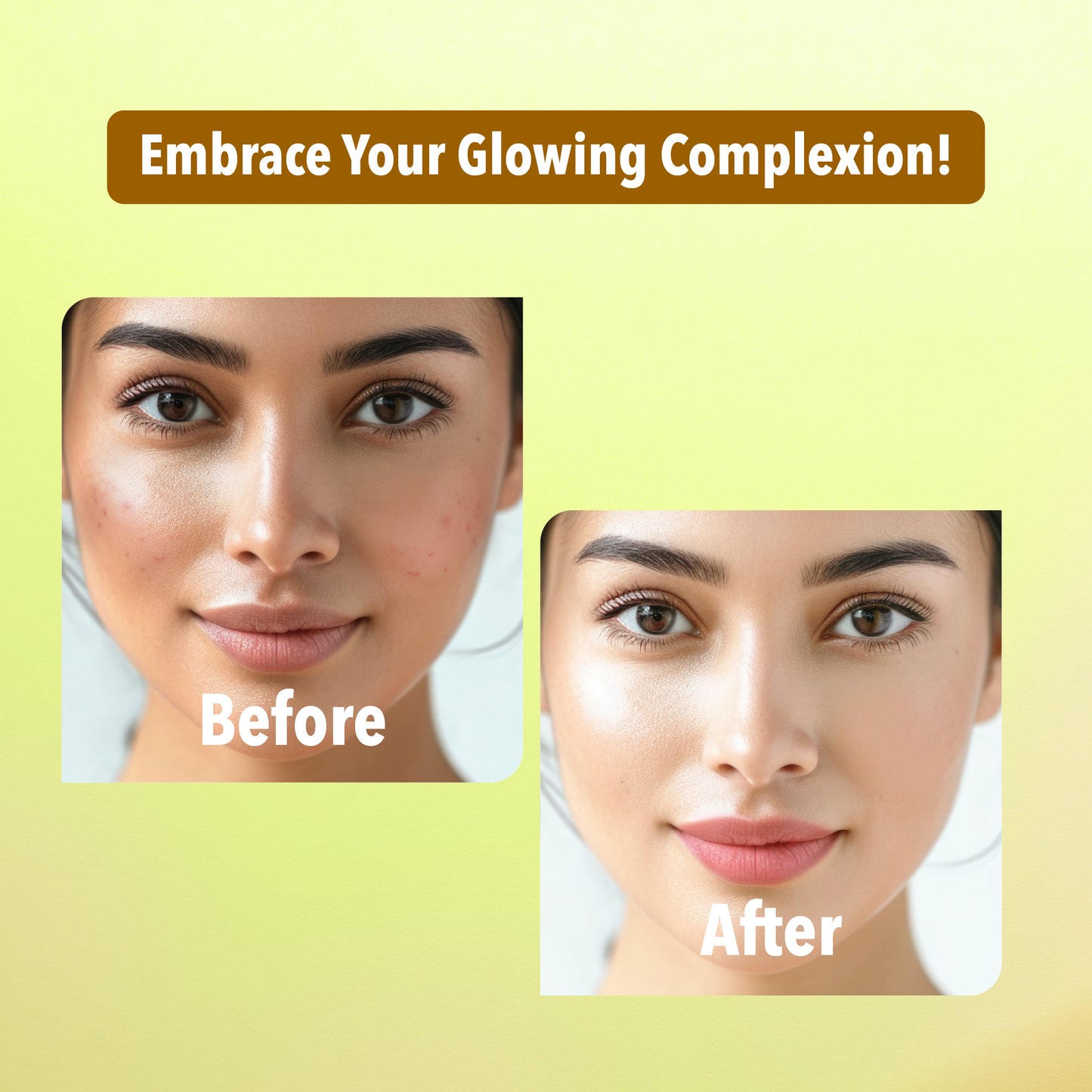 Rice Water Facial Pack of 4 ( Scrub, Gel, Cream & Facepack) - 1520 ml