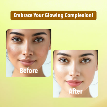 Rice Water Facial Pack of 4 ( Scrub, Gel, Cream & Facepack) - 1520 ml