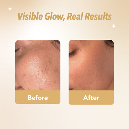 Rice Water Glow & Brightening Skincare Combo | Face Wash, Serum, Day Cream & Night Cream