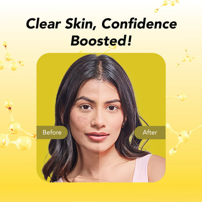 Bio Collagen Deep Facial Mask with salicylic acid