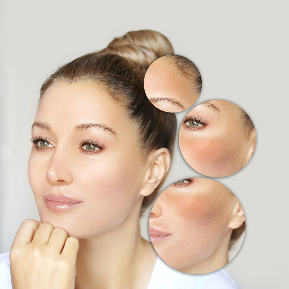 Custom image