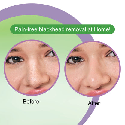 Tea Tree Nose Strips & Soothing Wet Wipes Combo Pack