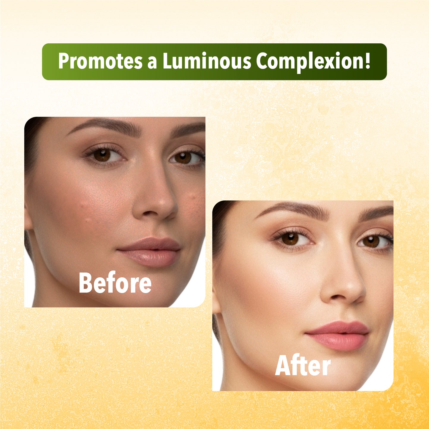 Ubtan Facial Pack of 4 (scrub, Gel, Cream & Facepack) - 1520 ml