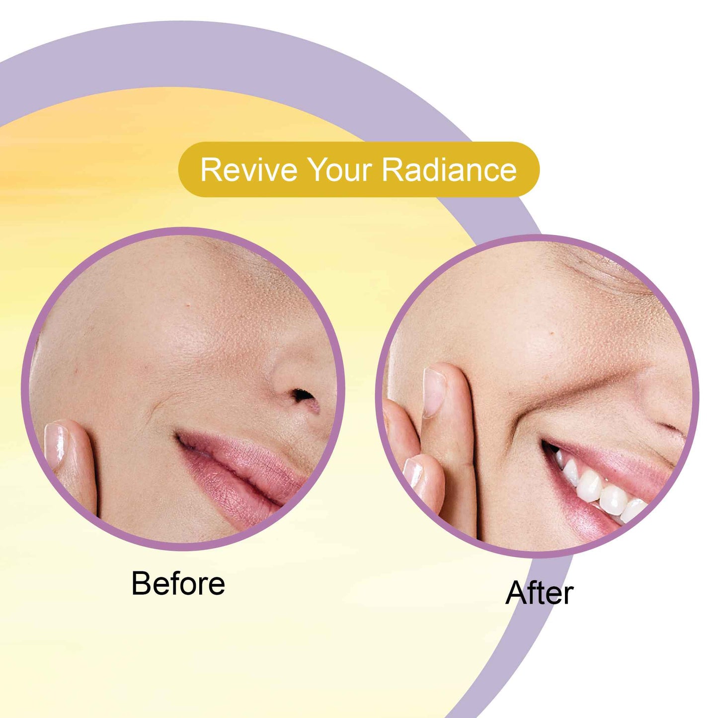 Ubtan Serum before after 