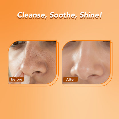 Vitamin C Nose Strips & Soothing Wet Wipes Combo Pack