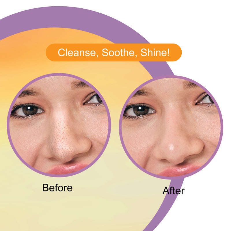 Vitamin C Nose Strips & Soothing Wet Wipes Combo Pack