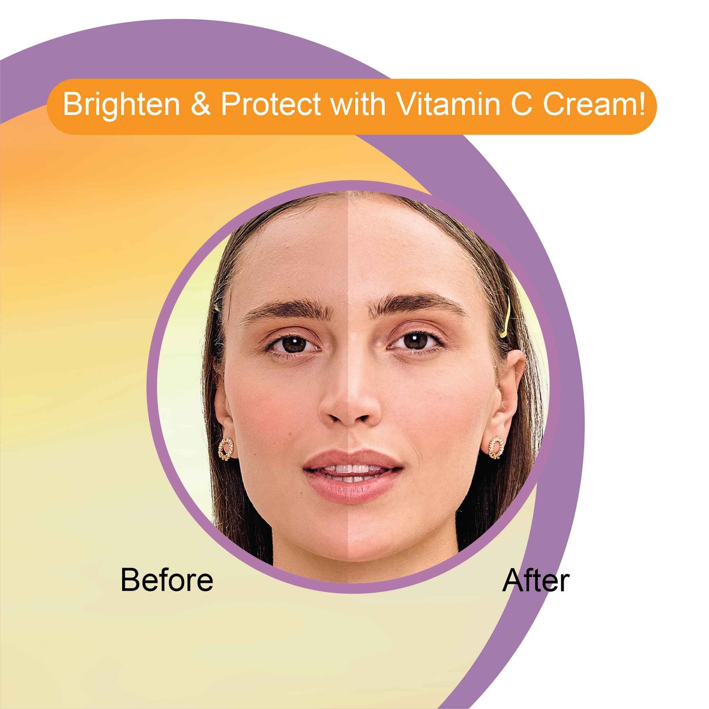 Vitamin C Cream Before After