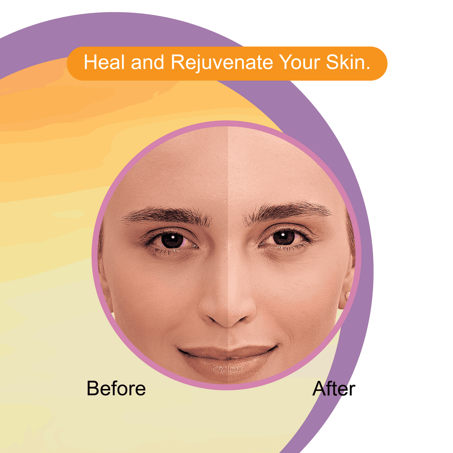 Vitamin C Night Cream Before After