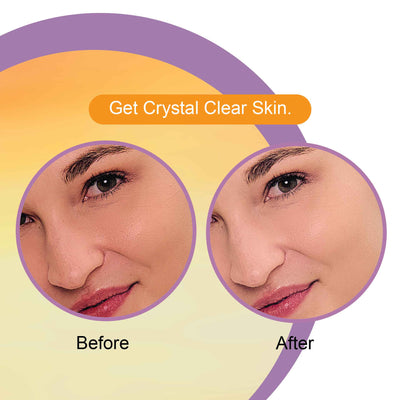 Vitamin c Face Wash before after