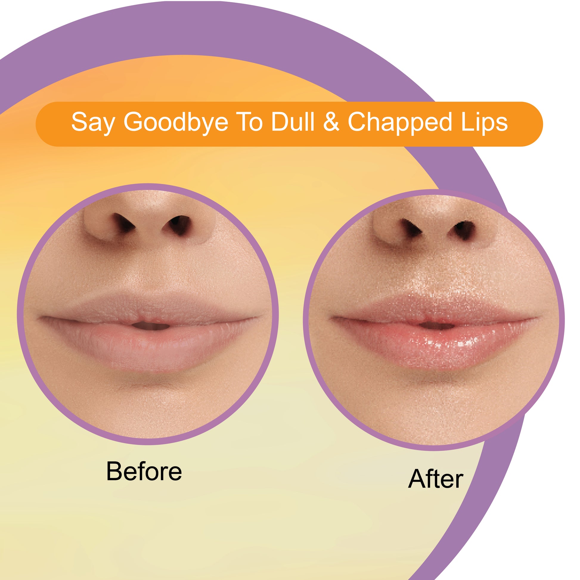 Vitamin C Lip Balm for Soft Lips - Dr.Rashel Vitamin C Lip Balm for Soft Lips - Dr.Rashel