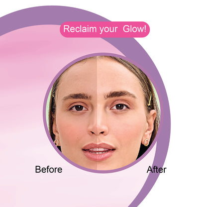 Uneven skin tone Kit