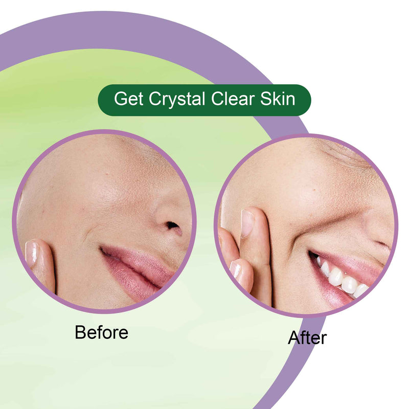 neem face wash for men and women