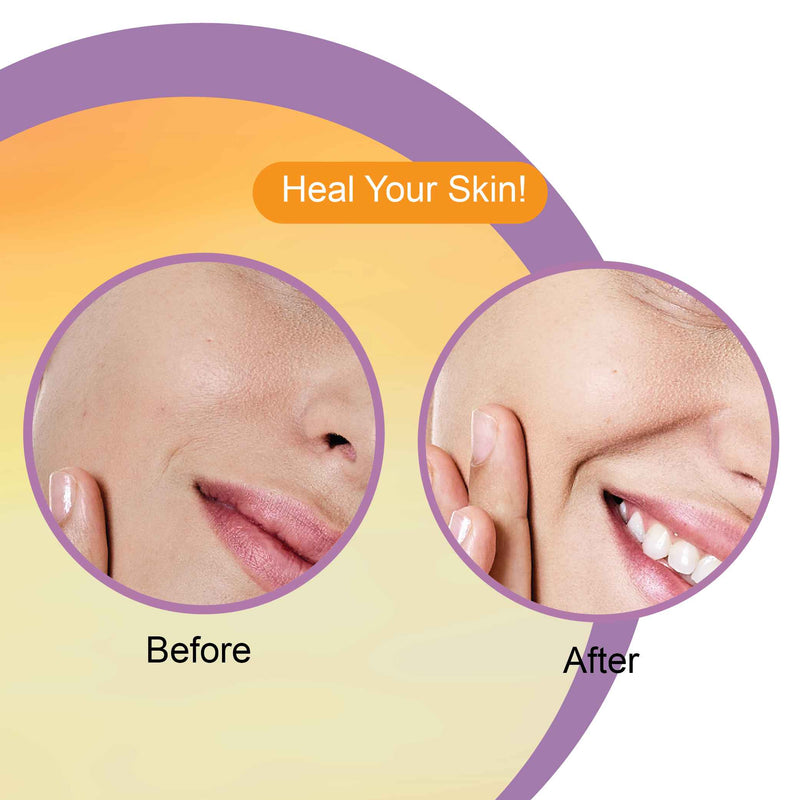 vitamin c serum for glowing skin in india